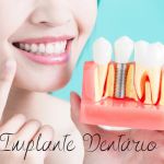 Como conseguir Implante dentário pelo SUS