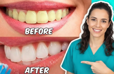 Get Your Teeth White With These 3 Steps: My Real Experience for a Brighter Smile